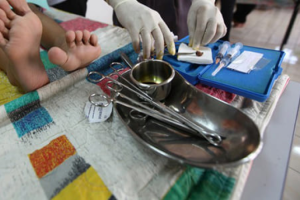 Sunat Perbaikan