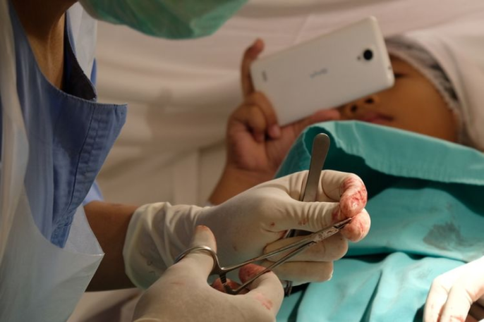 Sunat Terbaik di Jogja